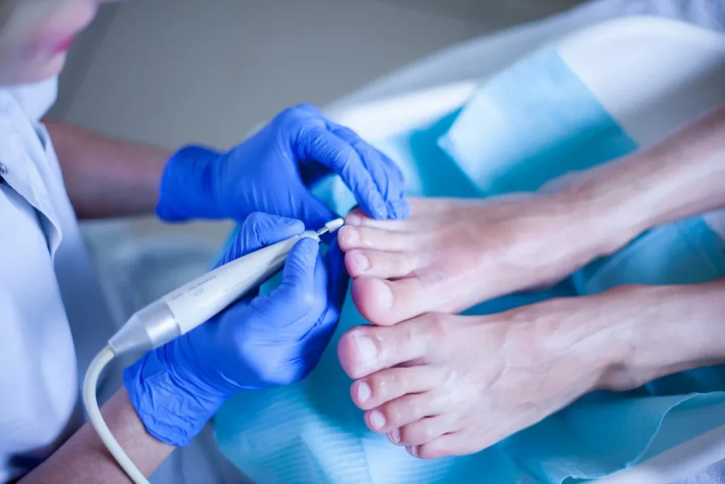 Pedicure De Graeve